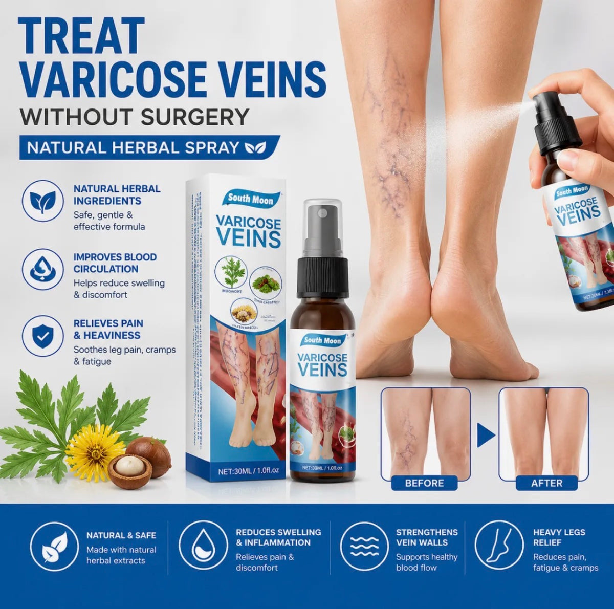 Natural Herbal Varicose Veins Spray South Moon Vein Care Spray 30ml Soothing