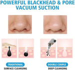 Multifunction Blackhead Remover – 5-in-1 Deep Pore Cleansing
